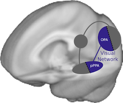 Visual network